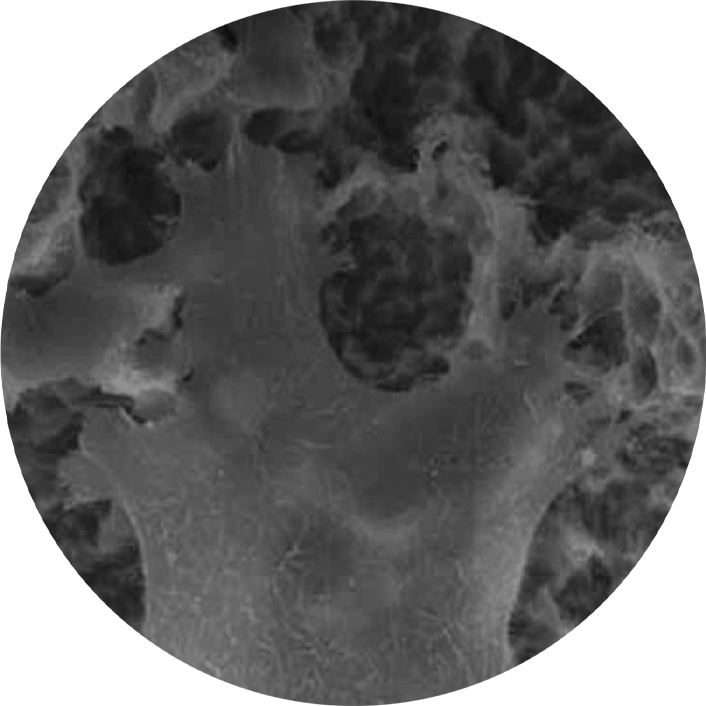 Yeni Soi İmplant Yüzeyi